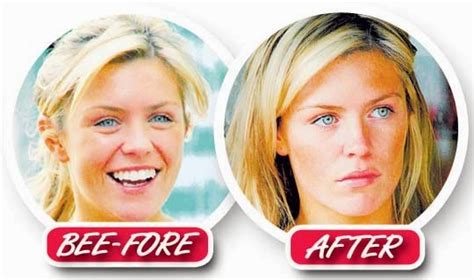 modelling abbey clancy before|abbey clancy before and after.